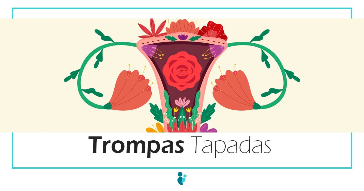 Trompas de Falopio Tapadas - Causas de Infertilidad Femenina