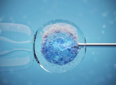 Fertilización in vitro (FIV)