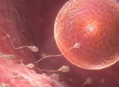 Inseminación artificial